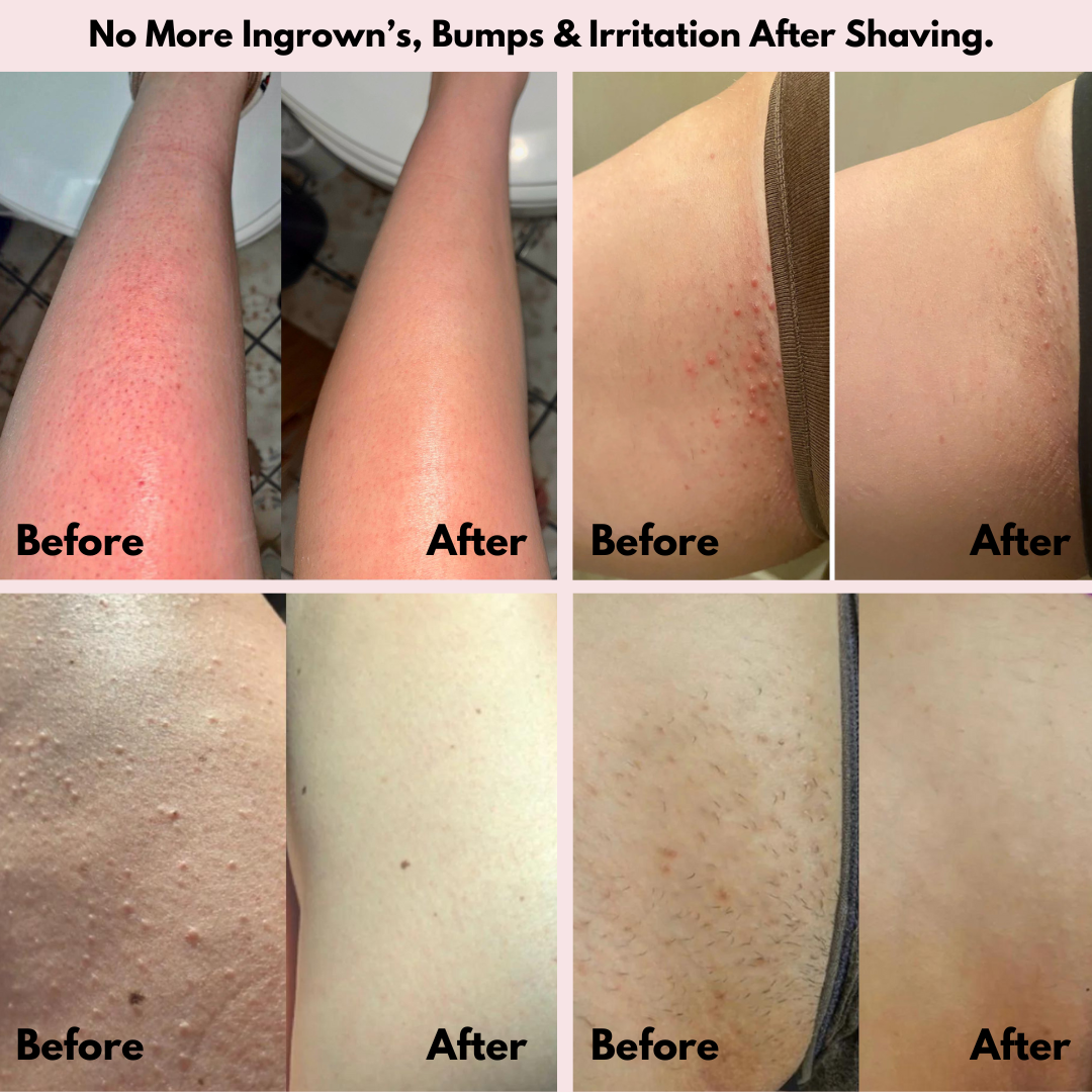 Orlina™ Smooth Shave Razor PRO 2.0